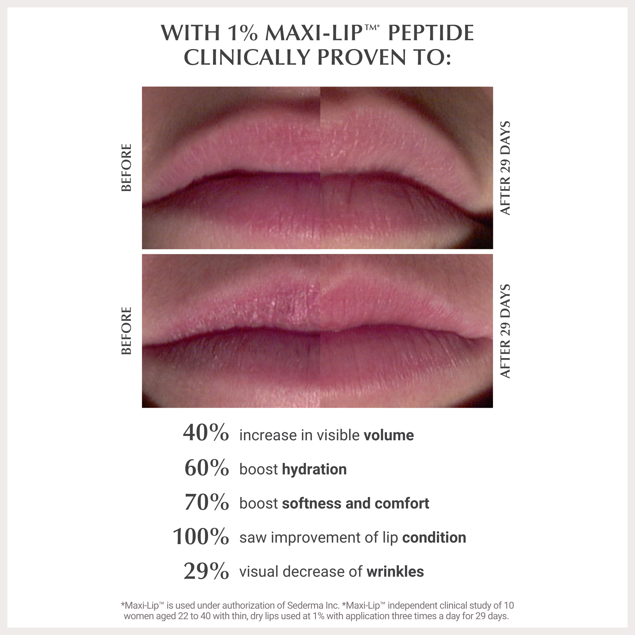 BUTTER BALM - BERRY JAM - TB5